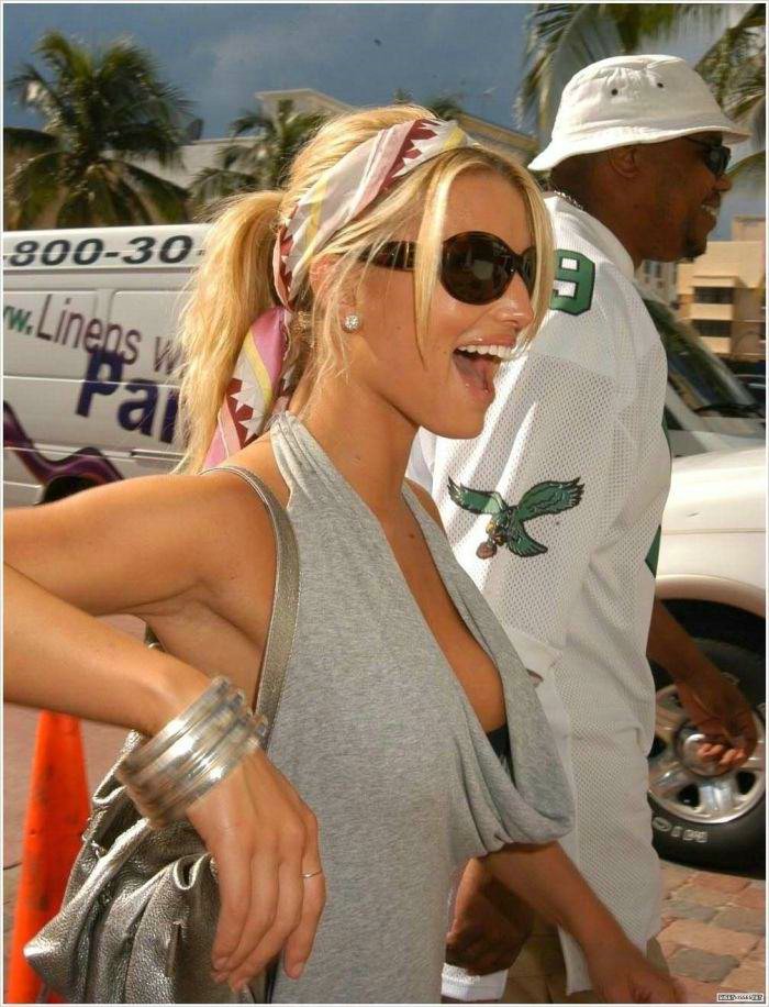 Jessica Simpson Accutane